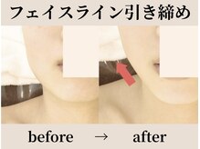 ガーデン(Garden)の雰囲気（【小顔EMS】表情筋からぐっと引き上げ、持続度の高い小顔へ）