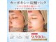 キレナル(KIRENAL)の写真