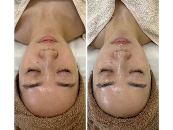 ジェニー(JENNI)/VVSダイヤモンドピーリング