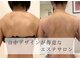 キラリス(Kilaris)の写真