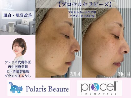 ポラリスボーテ 東京池袋の写真