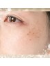 【50代人気No,1】くすみプラズマ＋毛穴洗浄¥18,000→¥6,600