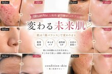 コンディションスキン(condition skin)