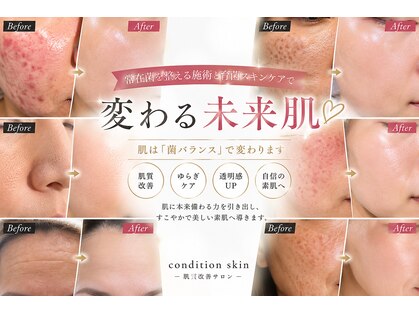 コンディションスキン(condition skin)の写真
