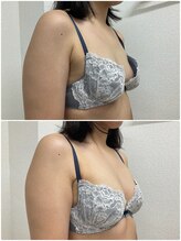 バーディー(BIRDIE)/施術１回/２０代