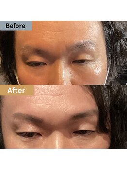 眉毛ハウス 吉祥寺店(眉毛HOUSE)/お客様の施術例(吉祥寺/東京)