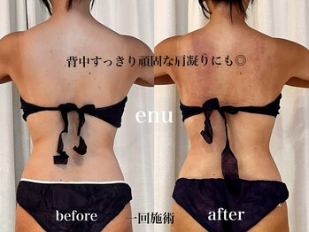 エヌ 白金台(enu)/背中の厚みがすっきり