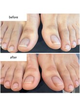 ケアプラス(care plus)/フットネイルケア