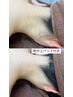 レディース【うなじ.背中上脱毛】(シェービング.背中パック付¥4480