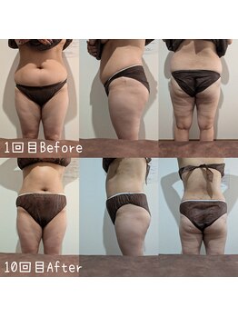 サロン ド モミカル(salon de momikaru)/