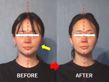 アトラス/初回のお客様のBefore＆after