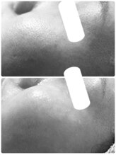 エルール トータルビューティ(Aileure total beauty)/ララピール×Wax