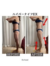 リヘッド(Re.head)/ハイパーナイフ　頑固な脂肪撃退