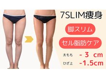 アマテビューティー ドット エヌ(アマテビューティー.N)の雰囲気（レモンボトル脂肪分解・微細針ノアグロウ・小顔・よもぎ蒸取扱店）