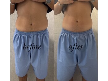 マホロバ セカンド(mahoroba 2nd)/メンズにも人気腸マッサージ