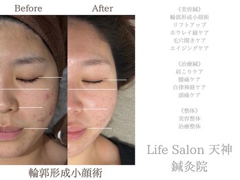 ライフサロン 天神(Life Salon)
