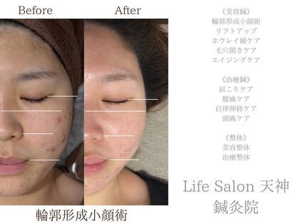 ライフサロン 天神(Life Salon)の写真