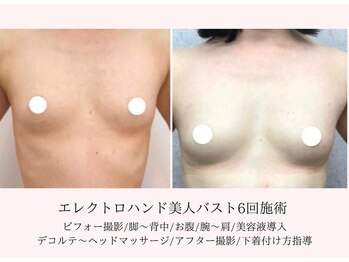 エイミー(Aimee)/授乳後のバストもふっくらUP