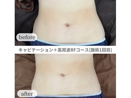 ラメール 神栖VENUS店(La mer)の写真