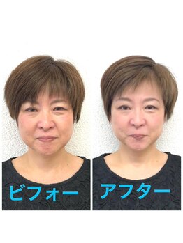 ビューティスタジオＫ/小顔矯正でシャープな輪郭