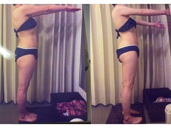 クイーン 札幌駅前店(Queen)/お客様 ビフォーアフター(6)