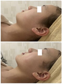 カレン(KAREN)/脂肪燃焼#小顔