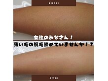 メロウ(mellow)の雰囲気（効果がなくて諦めていた薄い毛の脱毛にも効果◎）