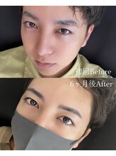 エス 浦添(S)/メンズ眉Before&After