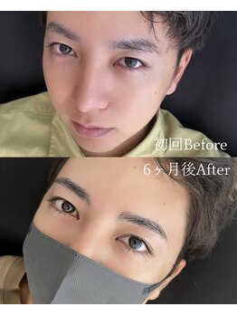 エス 浦添(S)/メンズ眉Before&After