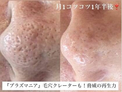 グラースア(grace a)の写真