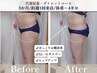 人気No.2【全身発汗】最先端よもぎ蒸し60分+全身リンパマッサージ15分