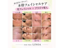 トータルビューティー ミミ(Total Beauty mimi)