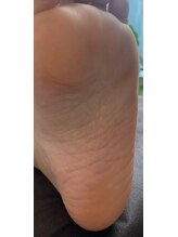 グリーングリーン(GREEN GREEN)/かかとのひび割れがふわふわに♪