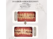 プラスビーセルフ(+b self)/ホワイトニングビフォーアフター