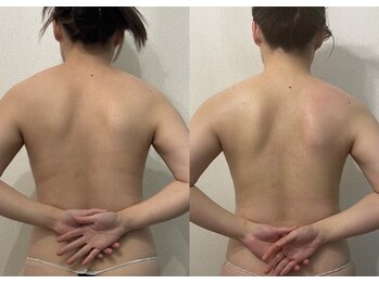 ミルジュ(MiLuJu)/パワーレメディー/凝り浮腫み