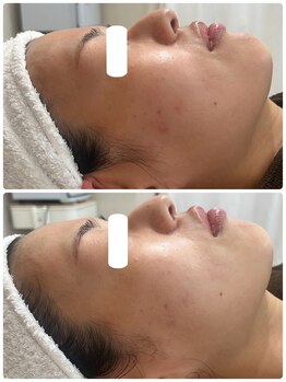 ムー(mu)/ララピール/トーンアップ