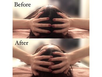 ブレスト サロン 奈良店(Bryst Salon)/小顔フェイシャル症例