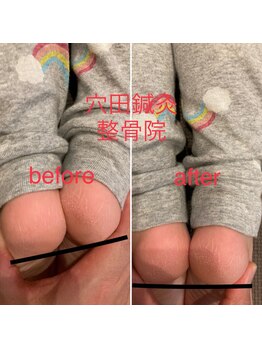 穴田鍼灸整骨院/整体・骨盤・ねこぜ・まき肩矯正