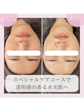 ミュー 豊田店(mieux)/◆水光肌になれます