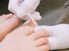 【歩く度痛い巻き爪に】痛みの少ない施術で巻き爪ケア♪ 1箇所￥5500→￥3300
