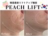 【小顔/リフトアップ】ピーチリフト〈500shot(全顔+顎下～首)〉¥16000⇒