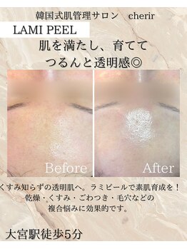 シェリール 大宮(cherir)/