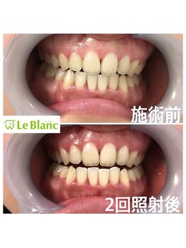 ルブラン 奈良店(Le Blanc)/ペア割り！1000円もお得に！