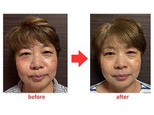 ブプラ 小倉店(BUPURA)/