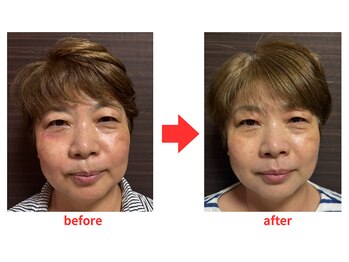 ブプラ 小倉店(BUPURA)/