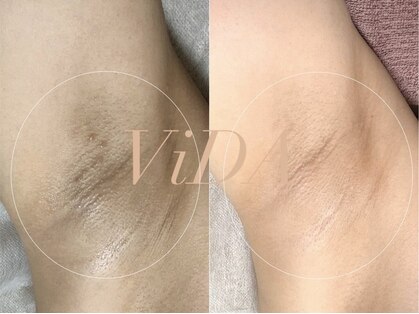 ヴィーダ 渋谷松濤(ViDA)の写真