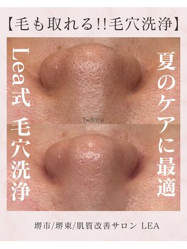 レア(Lea)/夏のケアに最適!!