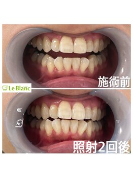 ルブラン 奈良店(Le Blanc)/見た目だけでなく