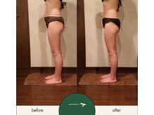 リラムーン(Relamoon)/ボディバザルト約１ヵ月4回で♪