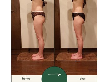 リラムーン(Relamoon)/ボディバザルト約1ヵ月4回で♪